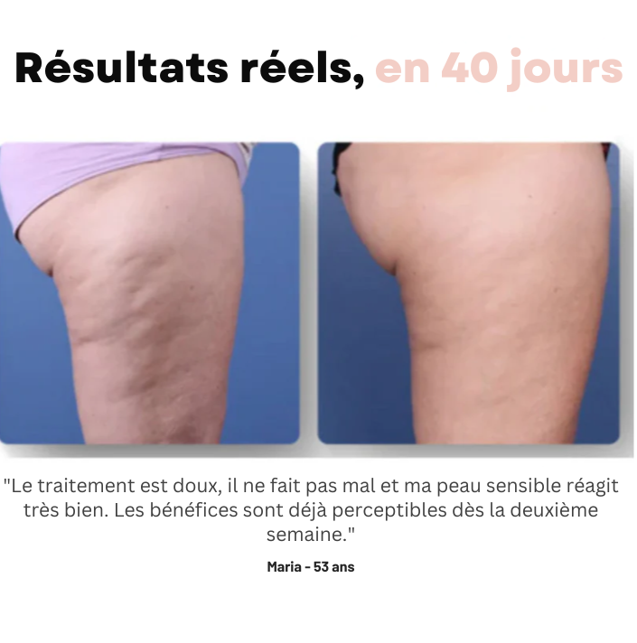 Softlift™ - Le secret d'une peau ferme, lisse et sans cellulite