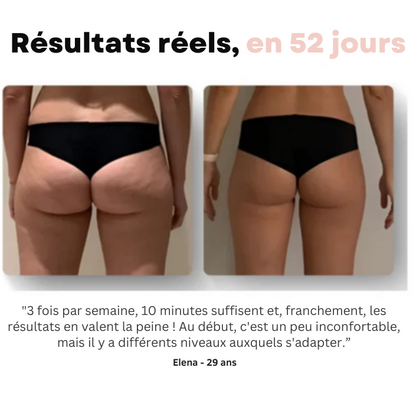 Softlift™ - Le secret d'une peau ferme, lisse et sans cellulite